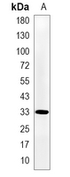 1 - Recombinant Anti-Annexin A5 Rabbit mAb AP95023