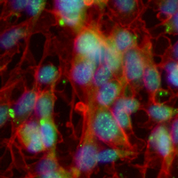 3 - Recombinant Anti-PGP9.5 Rabbit mAb AP95024
