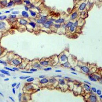 19 - Recombinant Anti-PGP9.5 Rabbit mAb AP95024