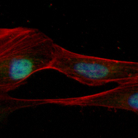 3 - Recombinant Anti-CTCF Rabbit mAb AP95025
