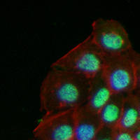 3 - Recombinant Anti-HCAP Rabbit mAb AP95026
