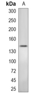 1 - Recombinant Anti-HCAP Rabbit mAb AP95026