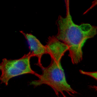3 - Recombinant Anti-FGFR3 Rabbit mAb AP95027