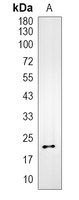 1 - Recombinant Anti-TIMP2 Rabbit mAb AP95028