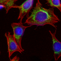 3 - Recombinant Anti-ATP5A1 Rabbit mAb AP95029