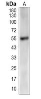 1 - Recombinant Anti-ATP5A1 Rabbit mAb AP95029