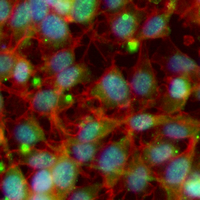 3 - Recombinant Anti-VCP Rabbit mAb AP95030