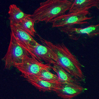 3 - Recombinant Anti-PABPN1 Rabbit mAb AP95031