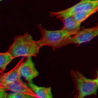 3 - Recombinant Anti-CD120b Rabbit mAb AP95032