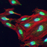 3 - Recombinant Anti-Ku70 Rabbit mAb AP95033