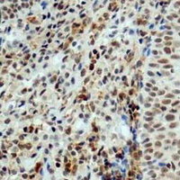 19 - Recombinant Anti-Ku70 Rabbit mAb AP95033