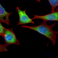 3 - Recombinant Anti-Adipophilin Rabbit mAb AP95034