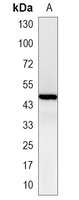 1 - Recombinant Anti-Adipophilin Rabbit mAb AP95034