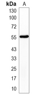 1 - Recombinant Anti-GATA4 Rabbit mAb AP95035