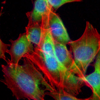 3 - Recombinant Anti-Transthyretin Rabbit mAb AP95036