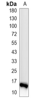 1 - Recombinant Anti-Transthyretin Rabbit mAb AP95036