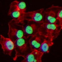 3 - Recombinant Anti-PML Rabbit mAb AP95037