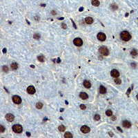 19 - Recombinant Anti-53BP1 Rabbit mAb AP95038