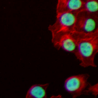 3 - Recombinant Anti-GATA3 Rabbit mAb AP95040