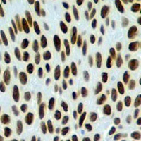 19 - Recombinant Anti-GATA3 Rabbit mAb AP95040