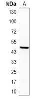 1 - Recombinant Anti-GATA3 Rabbit mAb AP95040