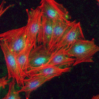 3 - Recombinant Anti-IKK gamma Rabbit mAb AP95041