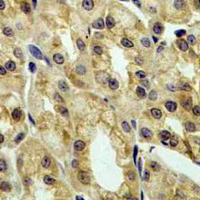19 - Recombinant Anti-IKK gamma Rabbit mAb AP95041