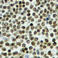 19 - Recombinant Anti-Rpb1 CTD (Phospho-S2) Rabbit mAb AP95042