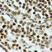 19 - Recombinant Anti-Rpb1 CTD (Phospho-S5) Rabbit mAb AP95043
