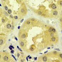 19 - Recombinant Anti-S100-A1 Rabbit mAb AP95044
