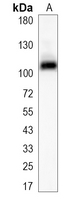 1 - Recombinant Anti-NFAT2 Rabbit mAb AP95047