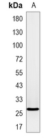 1 - Recombinant Anti-GDNF Rabbit mAb AP95048