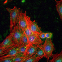 3 - Recombinant Anti-Annexin A2 Rabbit mAb AP95050