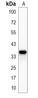 1 - Recombinant Anti-Annexin A2 Rabbit mAb AP95050