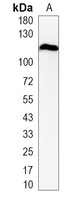 1 - Recombinant Anti-Involucrin Rabbit mAb AP95051