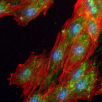 3 - Recombinant Anti-hnRNP A1 Rabbit mAb AP95052