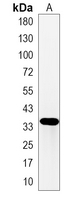 1 - Recombinant Anti-hnRNP A1 Rabbit mAb AP95052