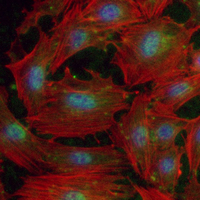 3 - Recombinant Anti-PIAS1/2 Rabbit mAb AP95053