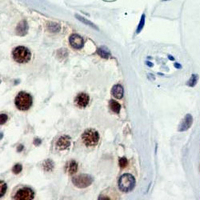 19 - Recombinant Anti-PIAS1/2 Rabbit mAb AP95053
