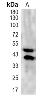 1 - Recombinant Anti-DR5 Rabbit mAb AP95054