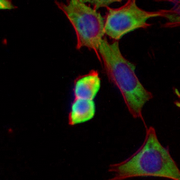 3 - Recombinant Anti-Calpain 1 Rabbit mAb AP95056