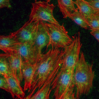 3 - Recombinant Anti-RELB Rabbit mAb AP95057