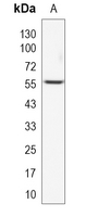 1 - Recombinant Anti-USP14 Rabbit mAb AP95058