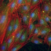 3 - Recombinant Anti-IRAK4 Rabbit mAb AP95061