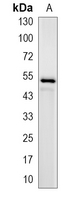 1 - Recombinant Anti-IRAK4 Rabbit mAb AP95061