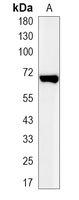 1 - Recombinant Anti-Glypican 3 Rabbit mAb AP95062