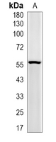 1 - Recombinant Anti-N-WASP Rabbit mAb AP95063