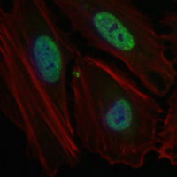 3 - Recombinant Anti-MTA2 Rabbit mAb AP95066