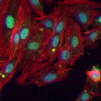 3 - Recombinant Anti-PDCD4 Rabbit mAb AP95068