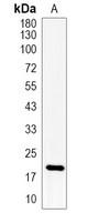 1 - Recombinant Anti-Ferritin L Rabbit mAb AP95069